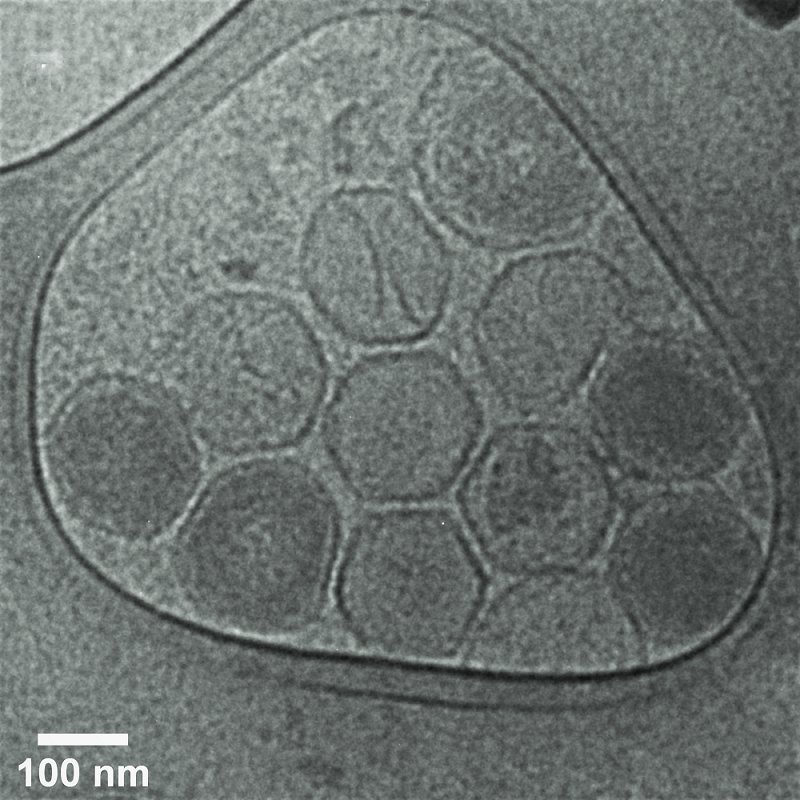11- marseillevírus por criomicroscopia
