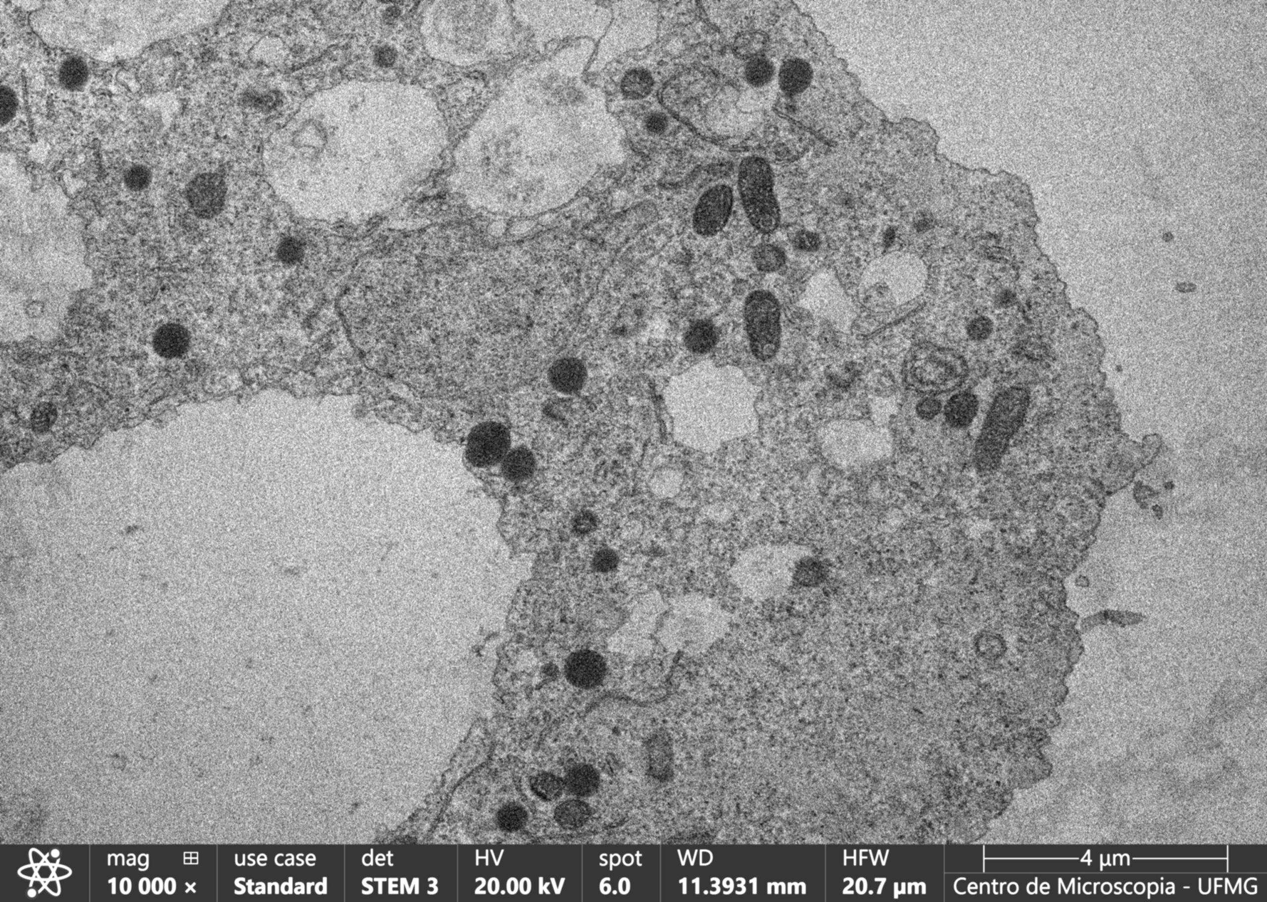 Acanthamoeba spp. infectada com vírus